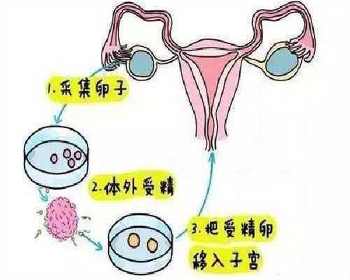 北京找捐卵人,试管婴儿捐卵供卵北京，2022北京正规公立医院做供